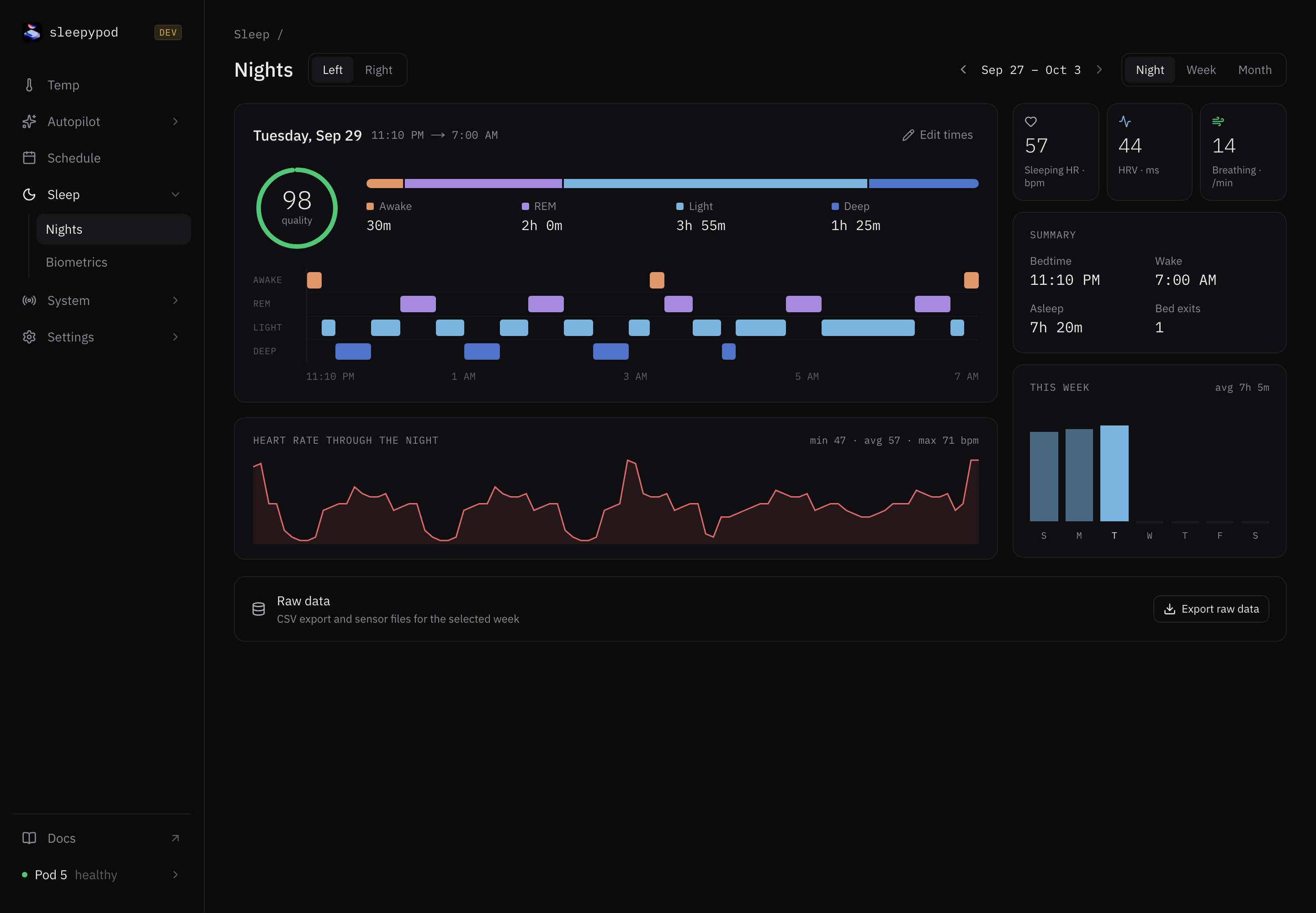 Real core Nights view showing an example sleep record